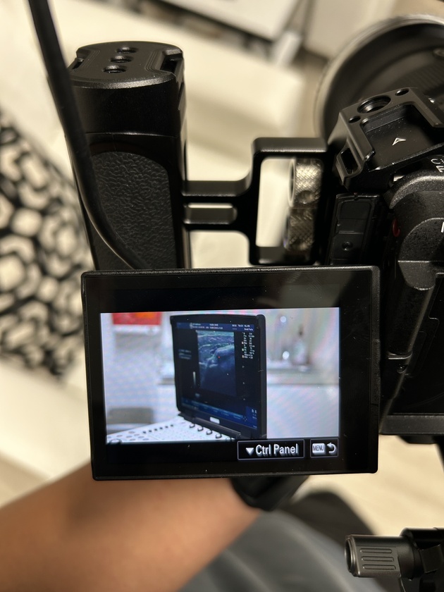 post photo preview