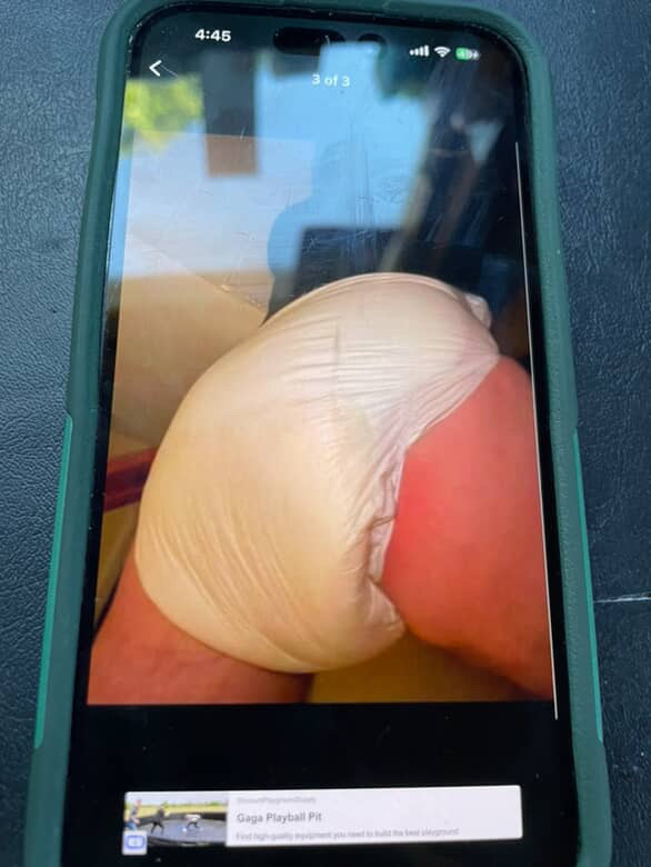 post photo preview