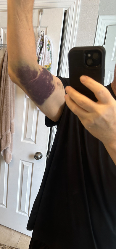 post photo preview