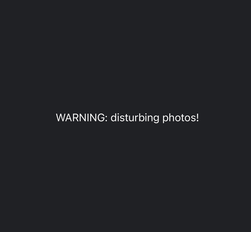 Shared post - Warning: Disturbing Photos